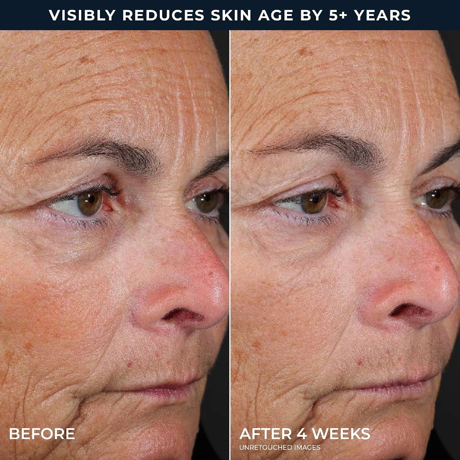 RoC Retinol Correxion Line Smoothing 2-Step Peel Pads - 5 Treatments