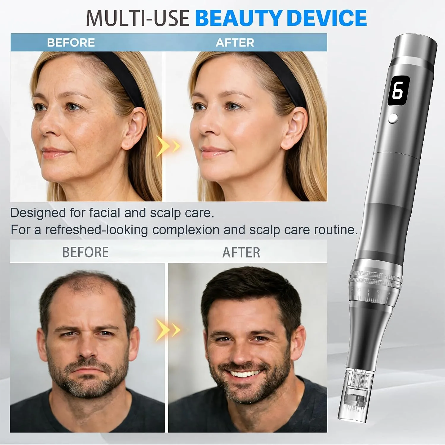 Microneedling Pen – Microneedle Derma Roller Pen for Home Use-0.25MM Grey