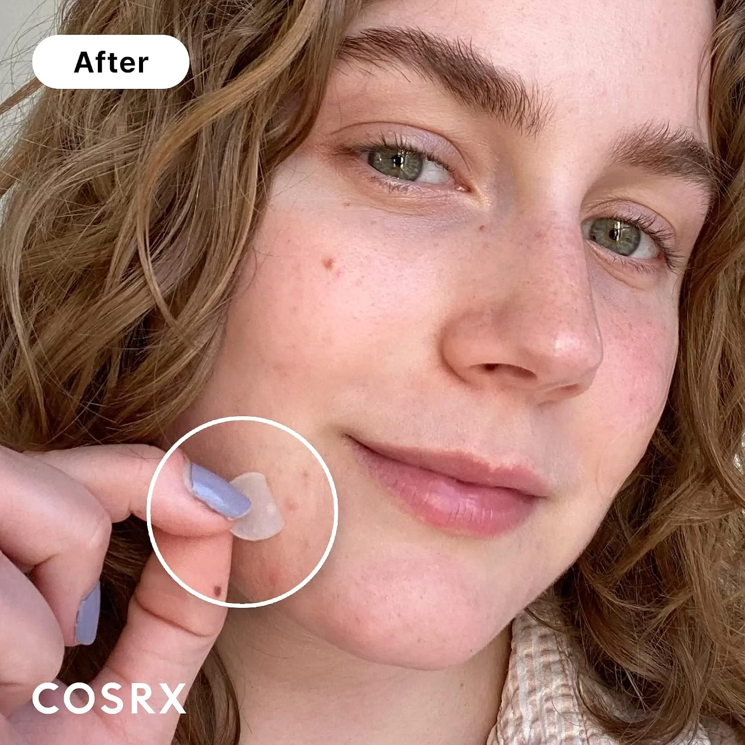 COSRX Acne Pimple Patches Absorbing Hydrocolloid Spot, 3 Size (72 Count)