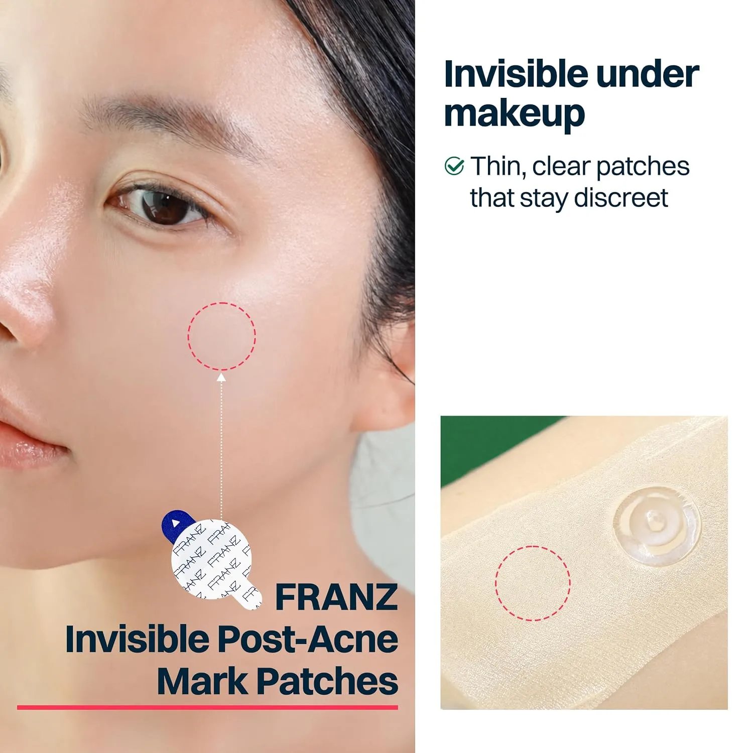 FRANZ Invisible Post-Acne Mark Patches for Dark Spots, 72 Count