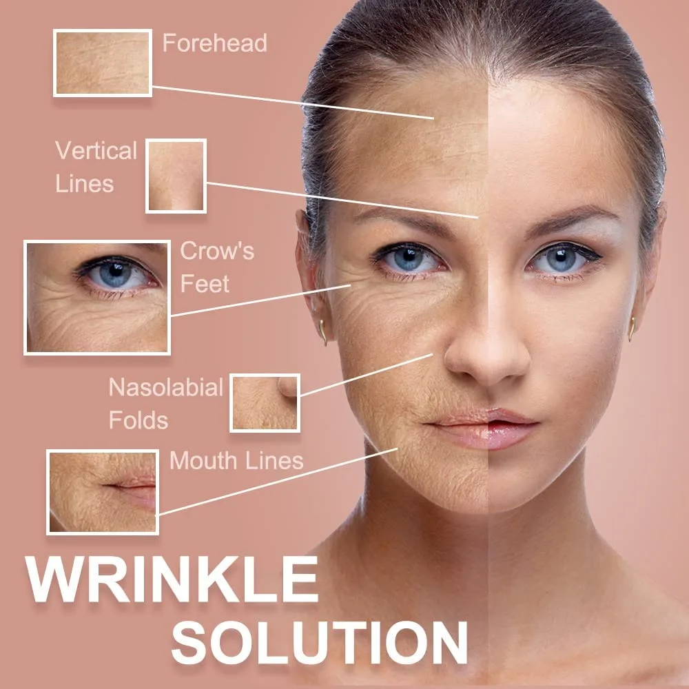 Akissos Forehead and Between Eyes Wrinkle Patches The Original Wrinkle Patch Non Invasive Wrinkle Smoothers for Forehead Wrinkles 5cm width