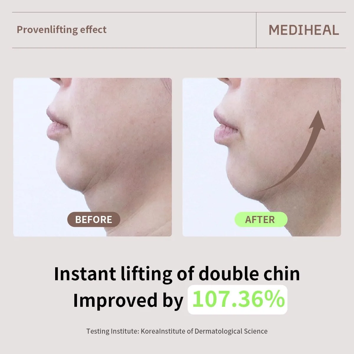 MEDIHEAL Retinol Collagen Cream Lifting Mask (4 Counts)