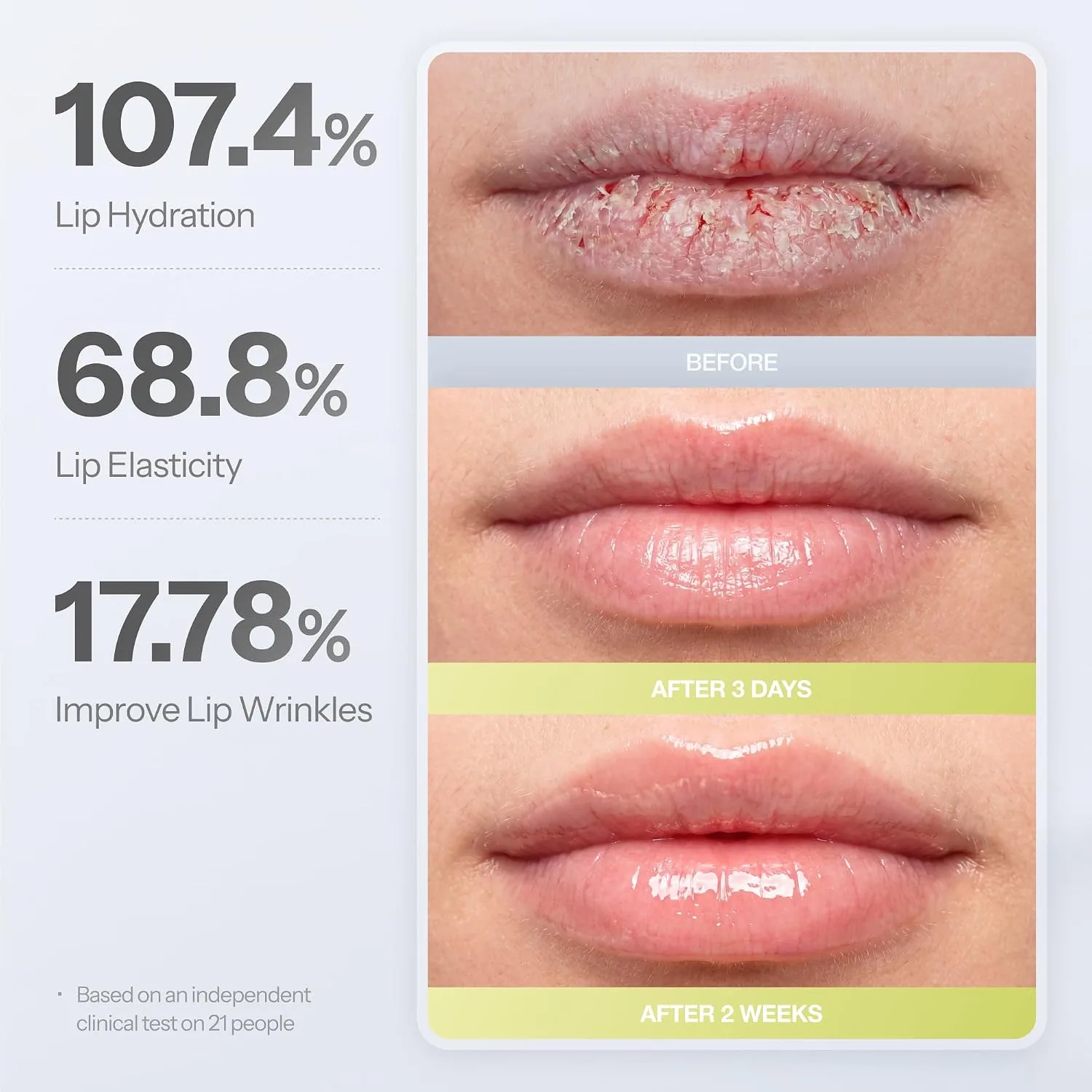 Dr.Different Retinal Lip Balm Clear, Anti-Wrinkle Lip Treatment with Deep Hydration & Long-Lasting Moisture, K-Skincare made by Korean Dermatologist, 0.14oz