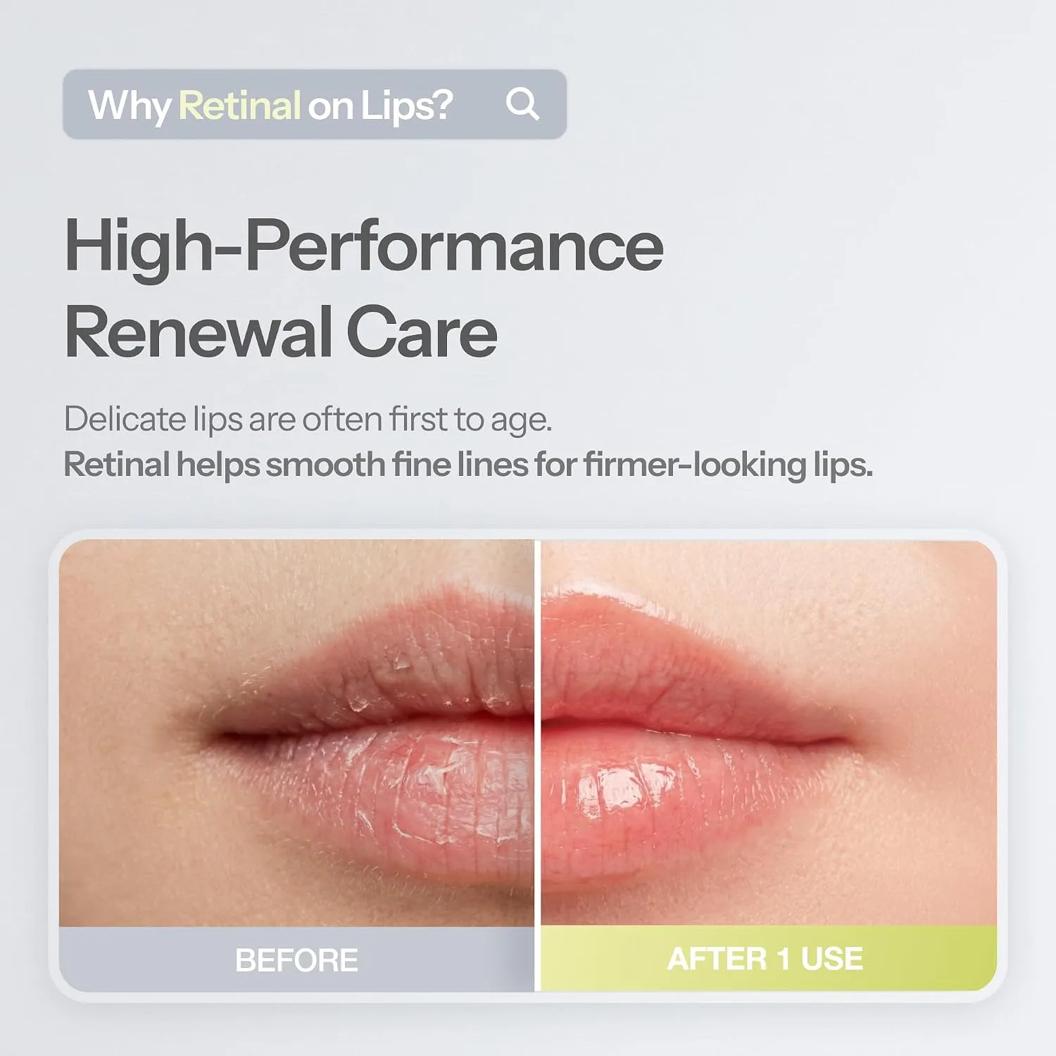 Dr.Different Retinal Lip Balm Clear, Anti-Wrinkle Lip Treatment with Deep Hydration & Long-Lasting Moisture, K-Skincare made by Korean Dermatologist, 0.14oz