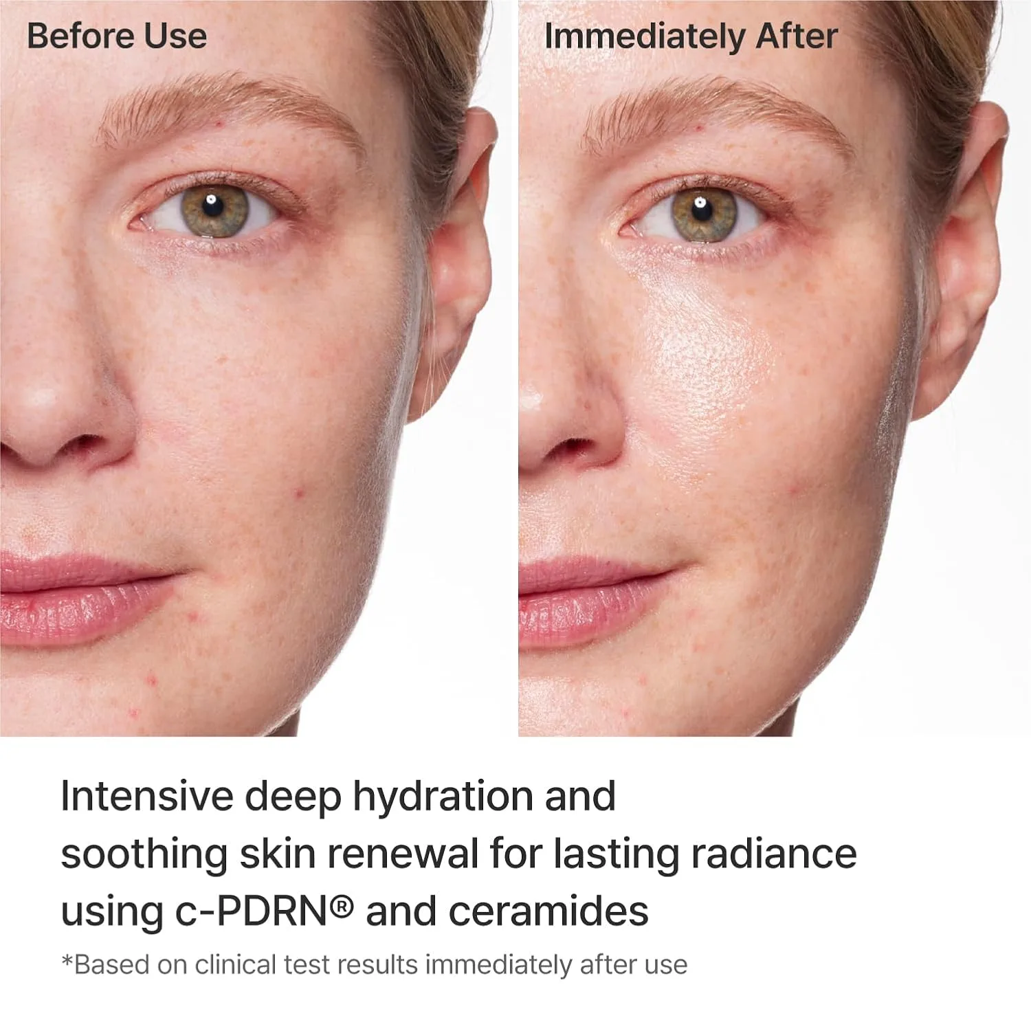 REJURAN Turnover Mask, c-PDRN® Face Mask, 5ea x 1.35 fl oz