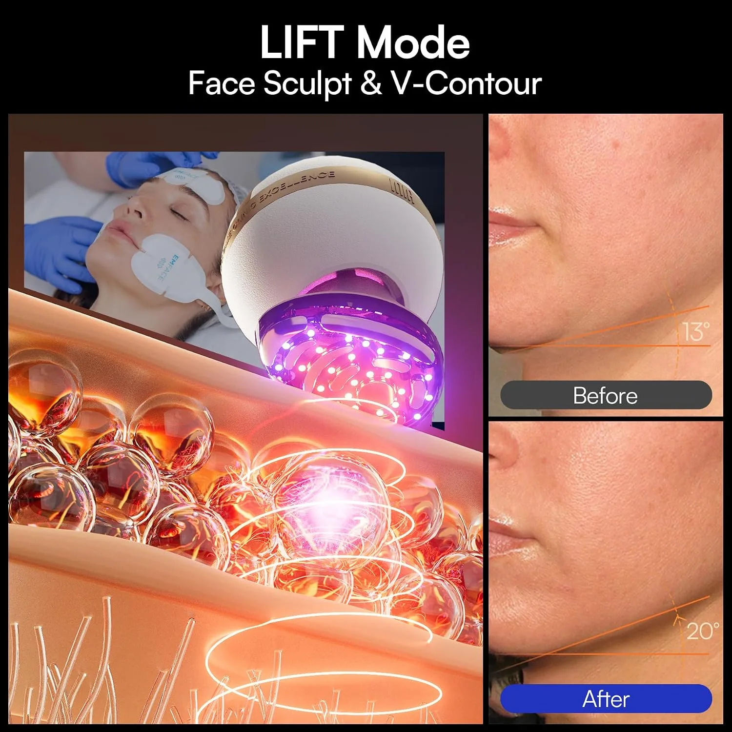 INIA SPHERA Upgraded 8-in-1 Microcurrent Facial Device for Face & Neck