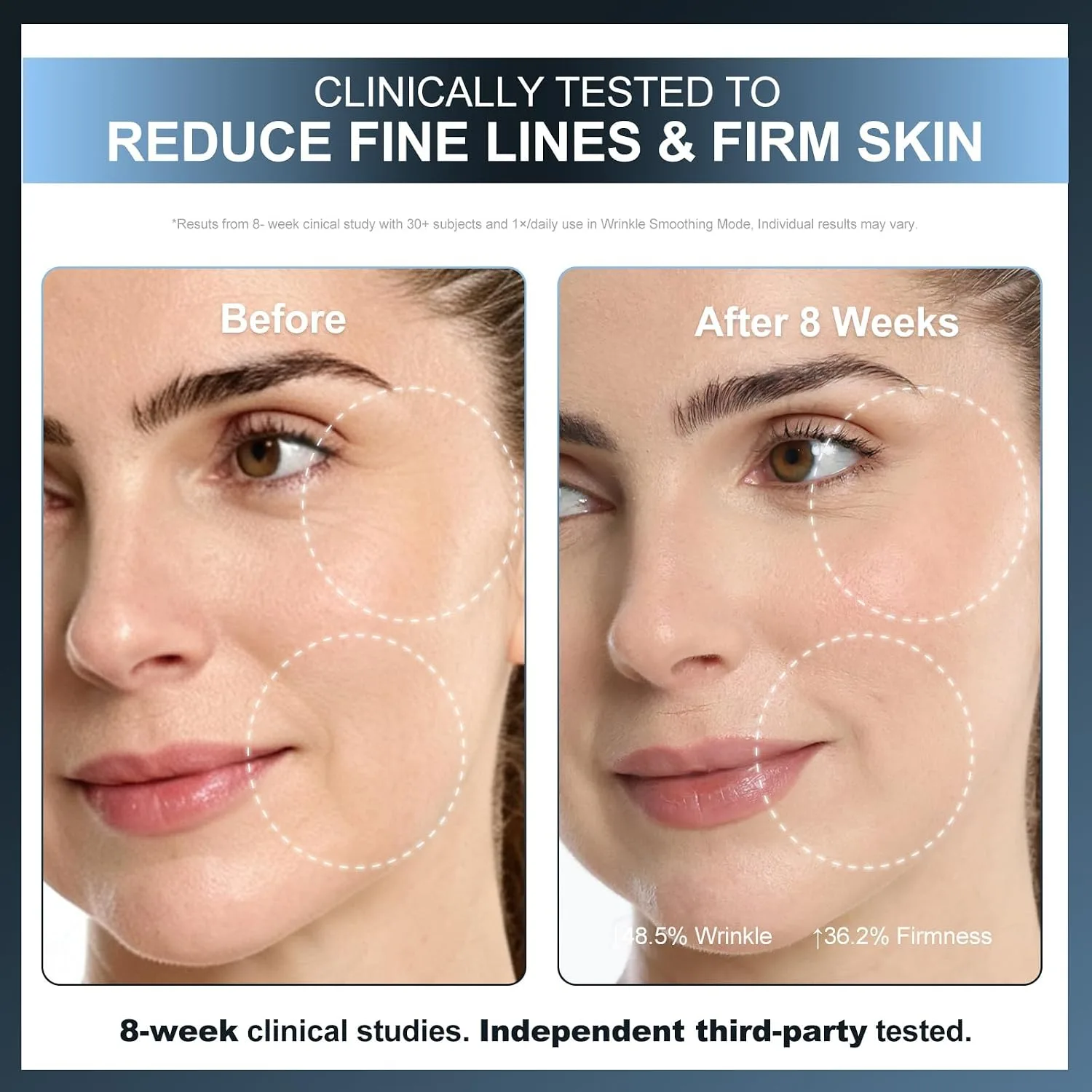 FDA Cleared 320 LEDs Red Light Therapy Mask for Face, Wireless
