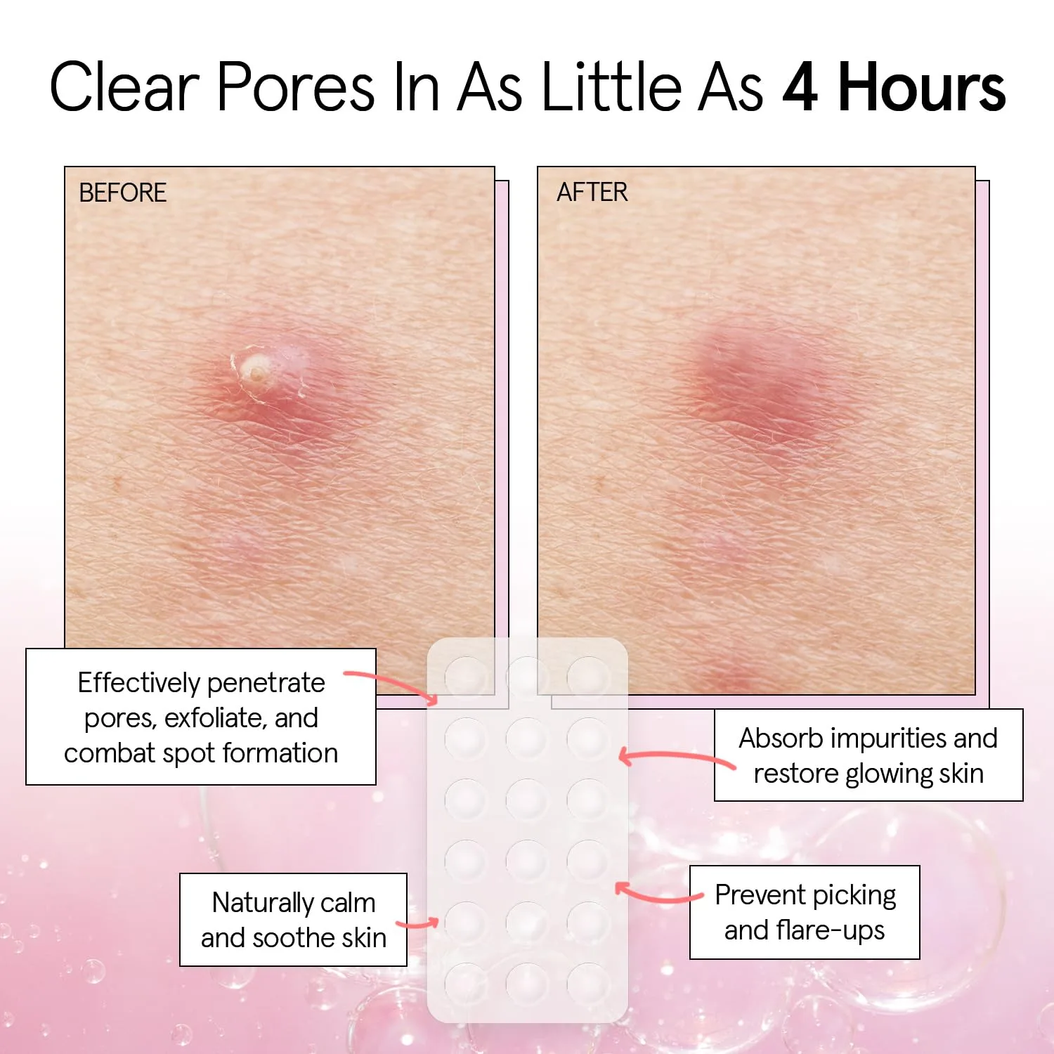 grace & stella Award Winning Multi-Size Pimple Patches for Face