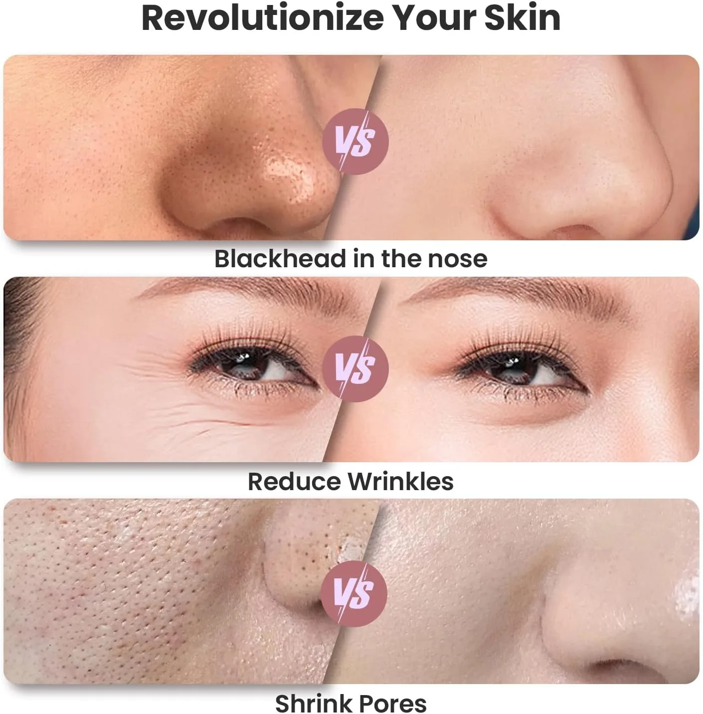 UNOISETION Diamond Microdermabrasion Machine, Portable Blackhead Remover Pore Vacuum, Dermabrasion Facial Machine for Exfoliation & Blackhead Removal