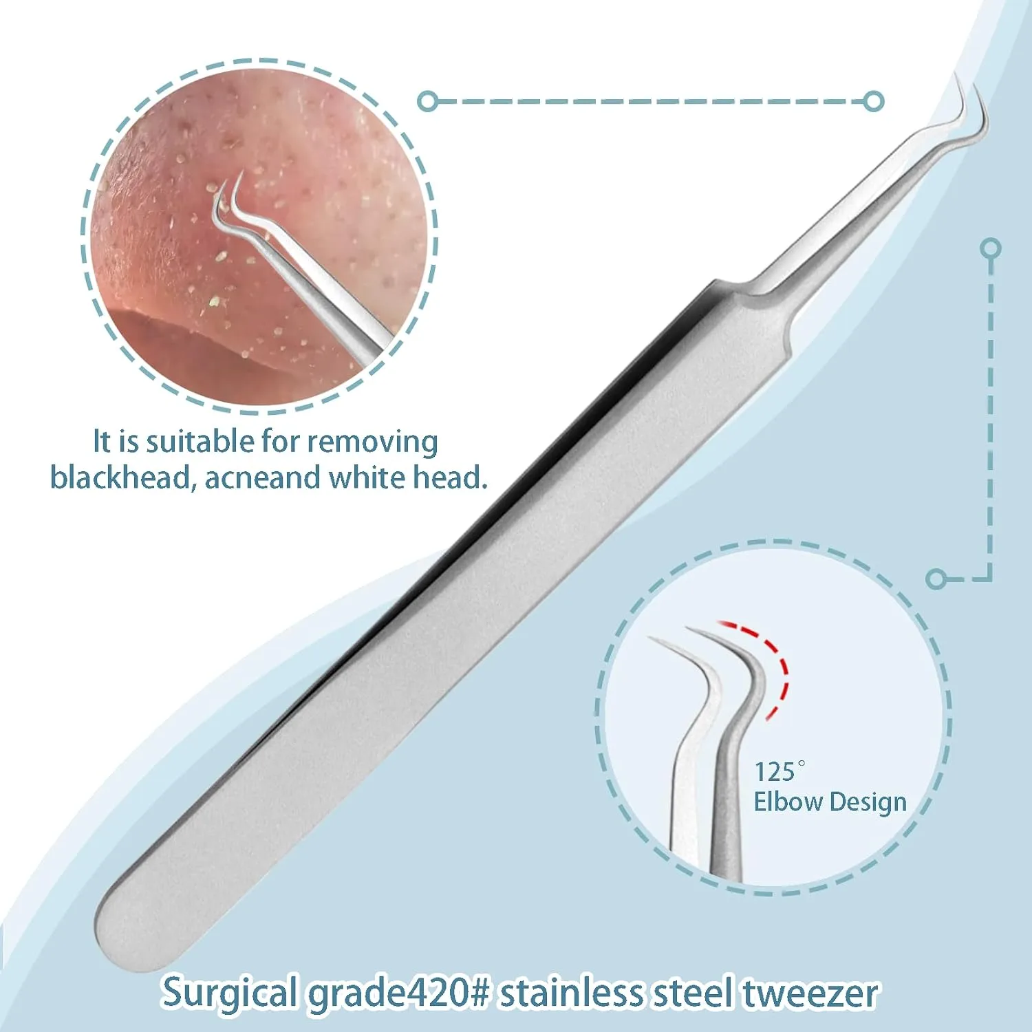 SGNEKOO Professional Milia and Blackhead Remover Tool Kit