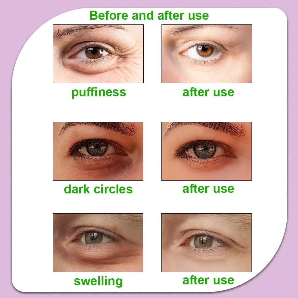 Hot and Cold Eye Pads, Reusable Eye Patches