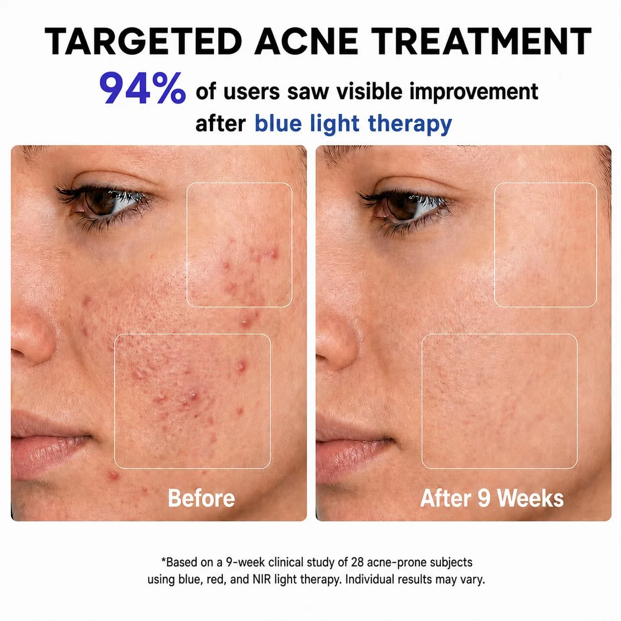 Red Light Therapy for Face Mask, Blue Light Therapy for Acne, Gifts for Women, Wrinkle LED Face Mask, 432 LED with Full Face Coverage & 3 Light Modes, Travel Bag for Home Use & Travel