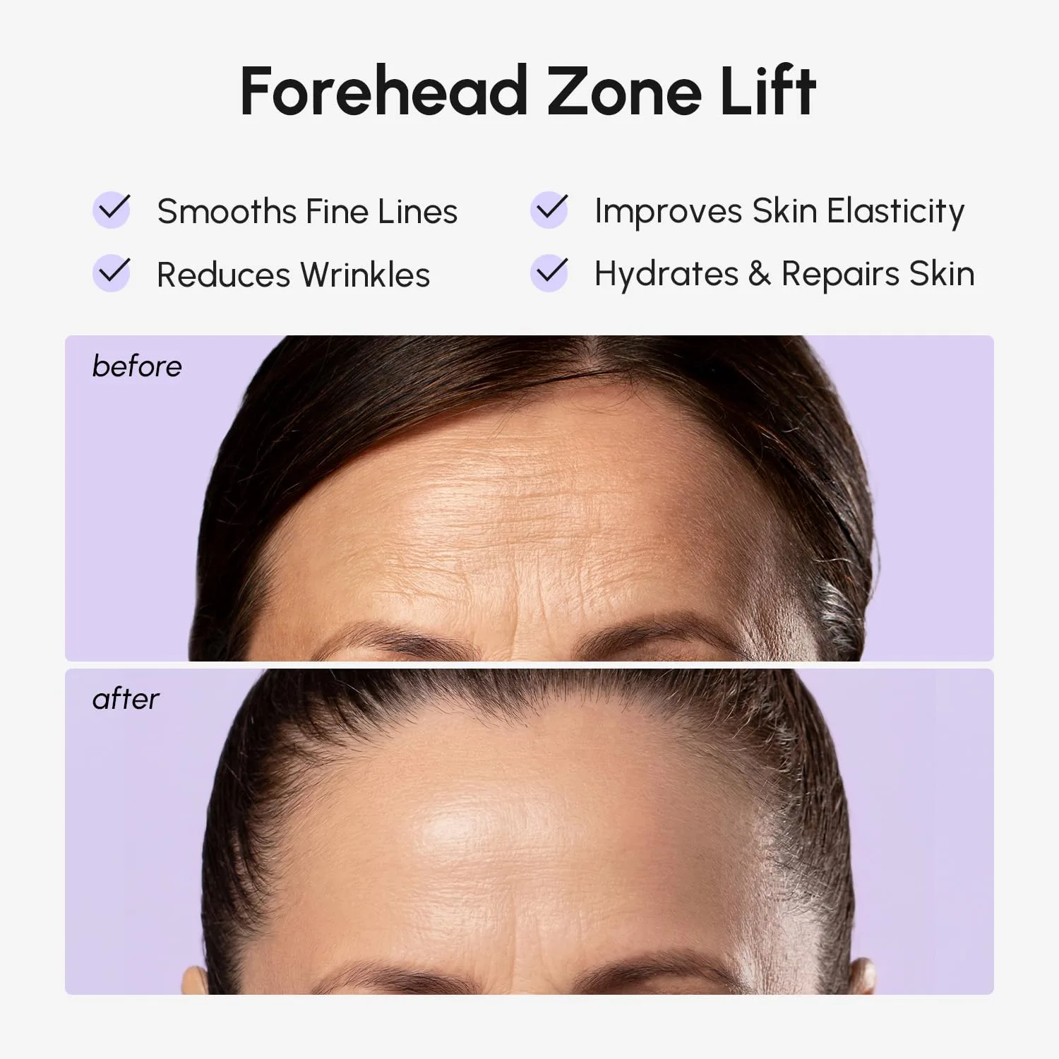 MAREE Forehead Wrinkle Patches & Facial Mask - Anti Wrinkle Patches 10 Ct