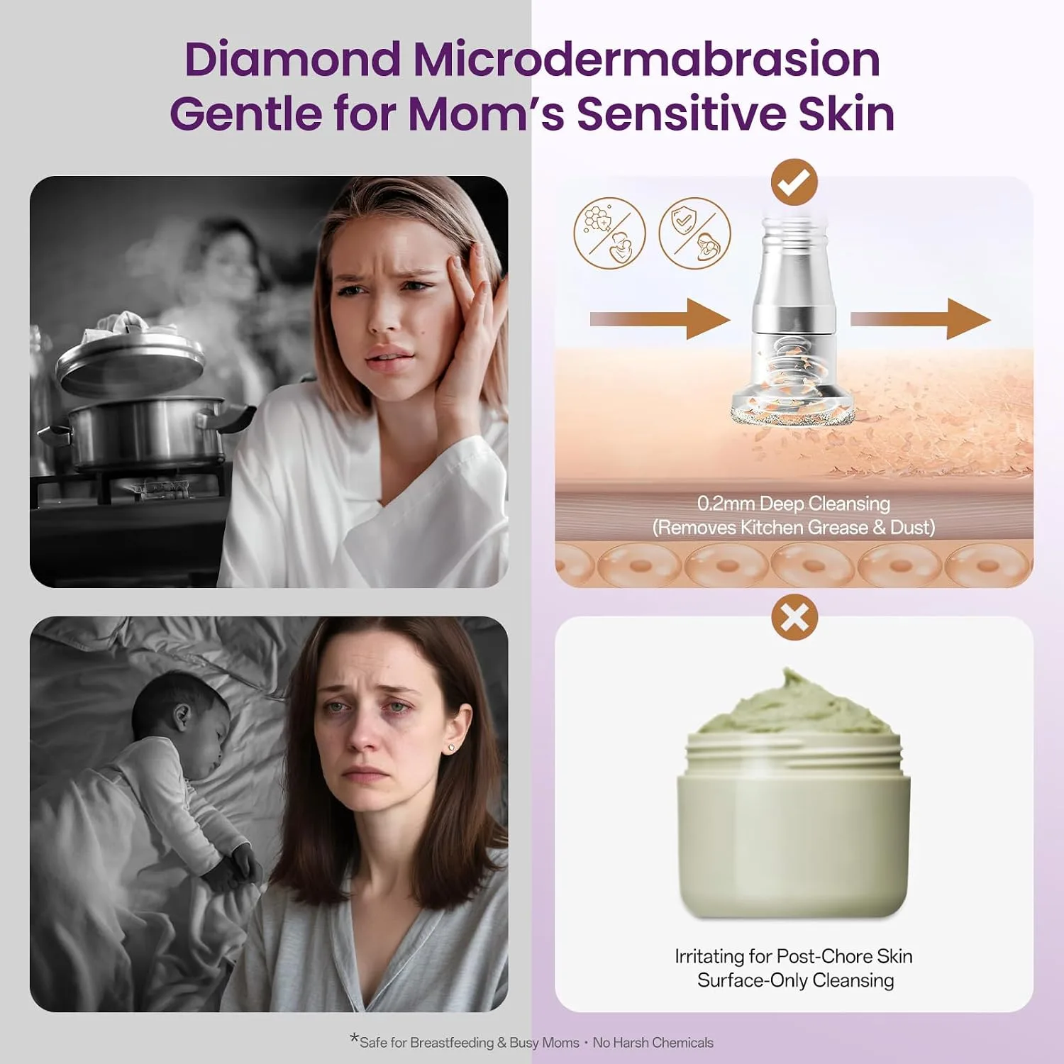 UNOISETION Diamond Microdermabrasion Machine (Pure White)