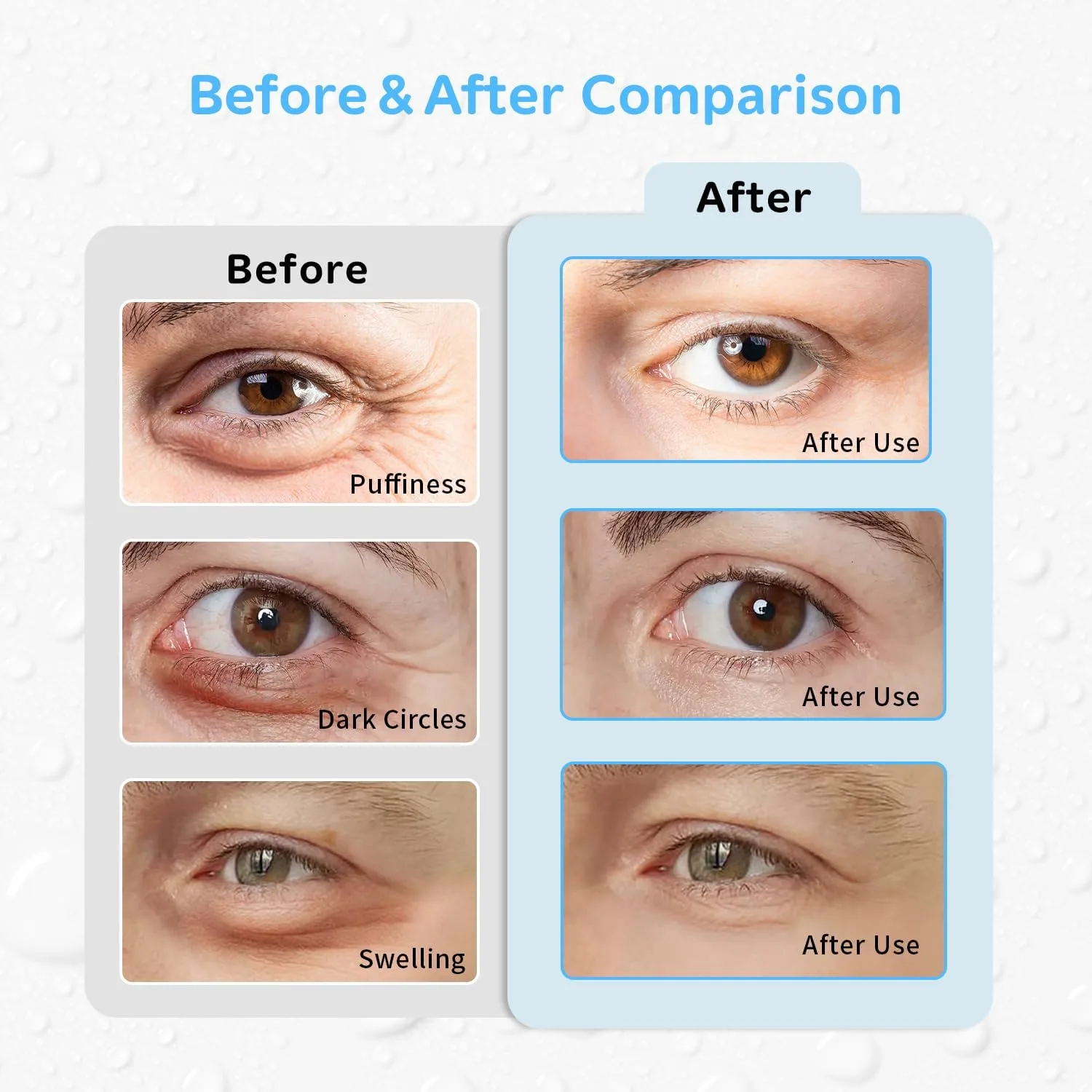 4PCS Gel Eye Ice Pack Set Reusable, Cold and Hot Compress for Eyes