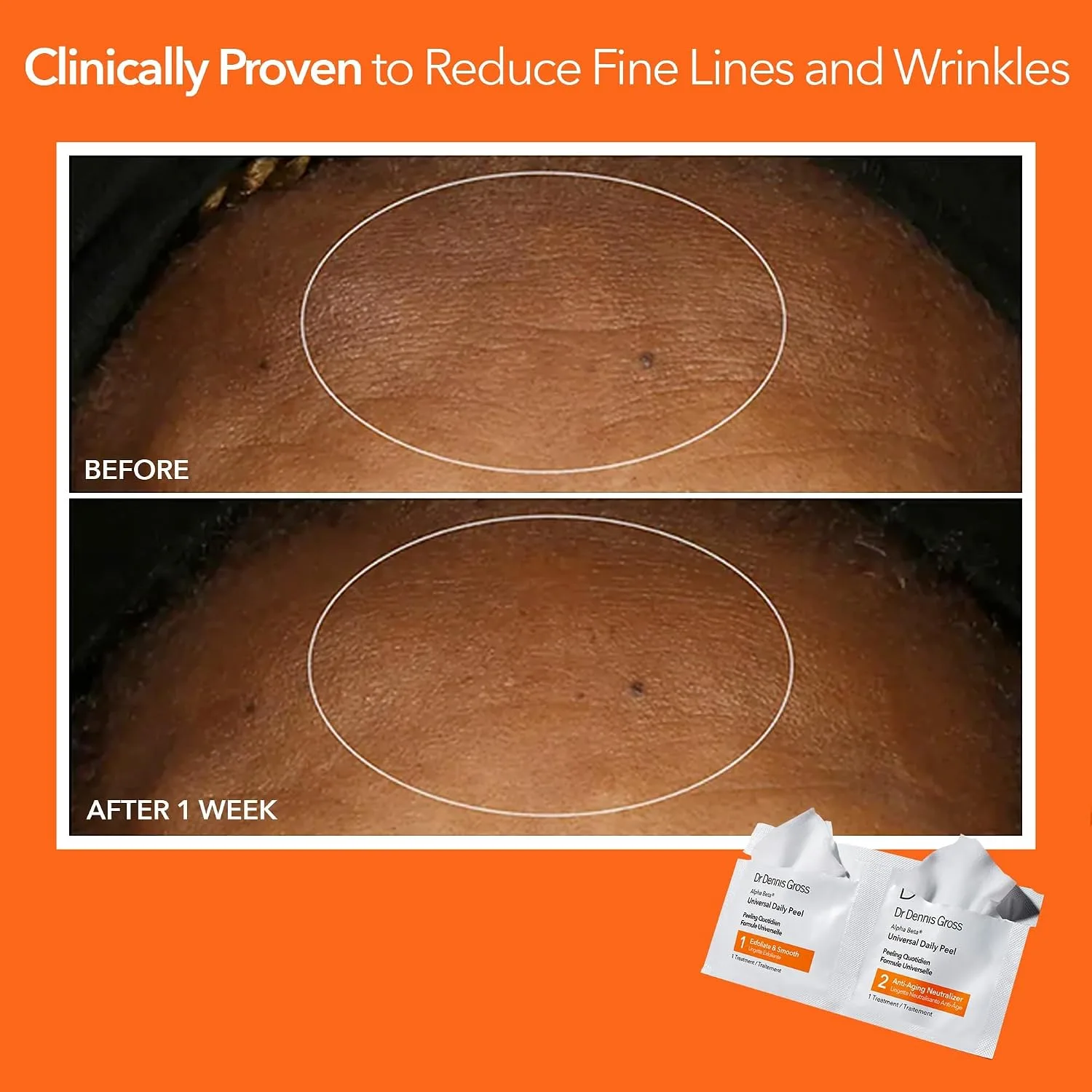 Dr Dennis Gross Alpha Beta Universal Exfoliating Daily Peel - 5 Pack