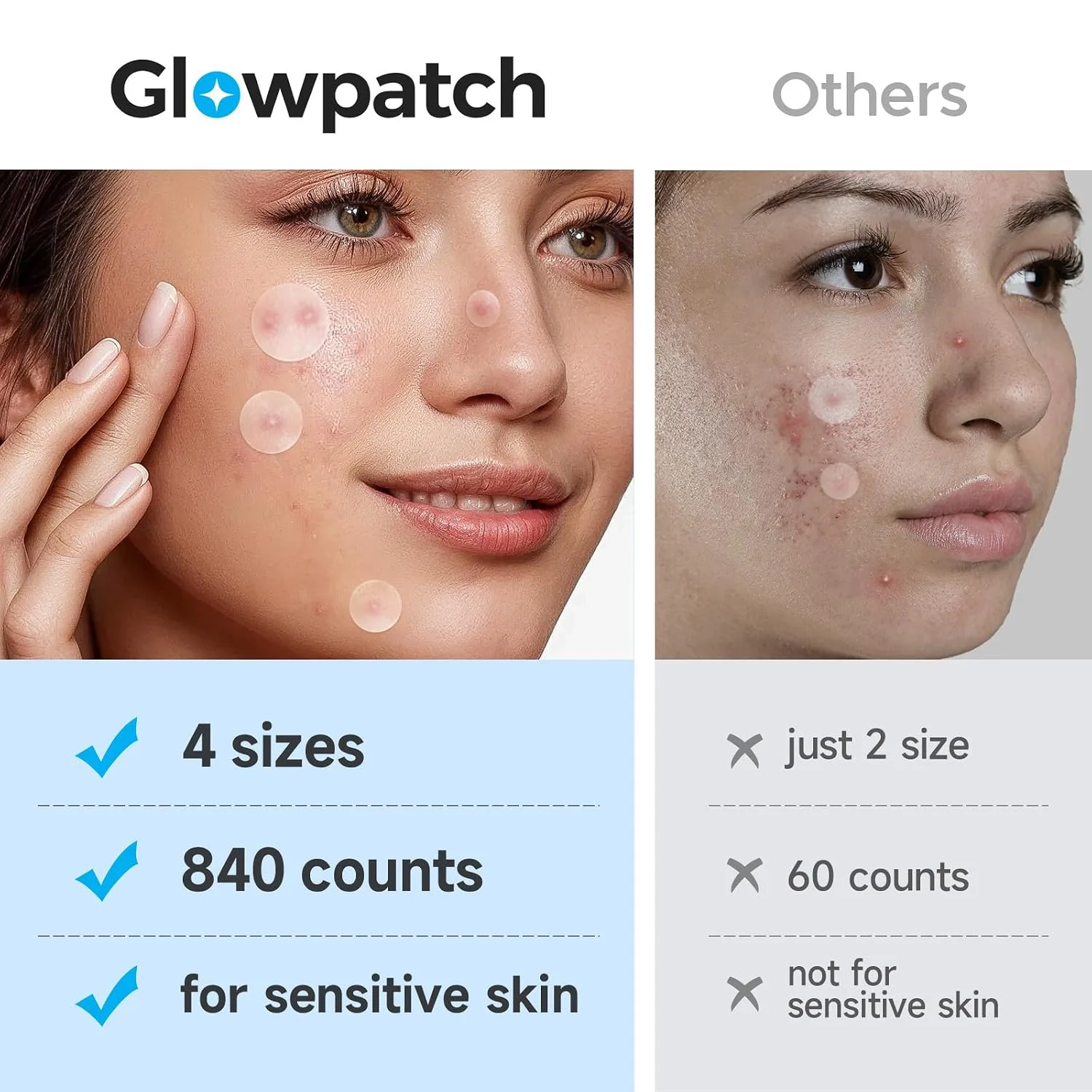 840 Counts 4 Sizes Pimple Patches for Face