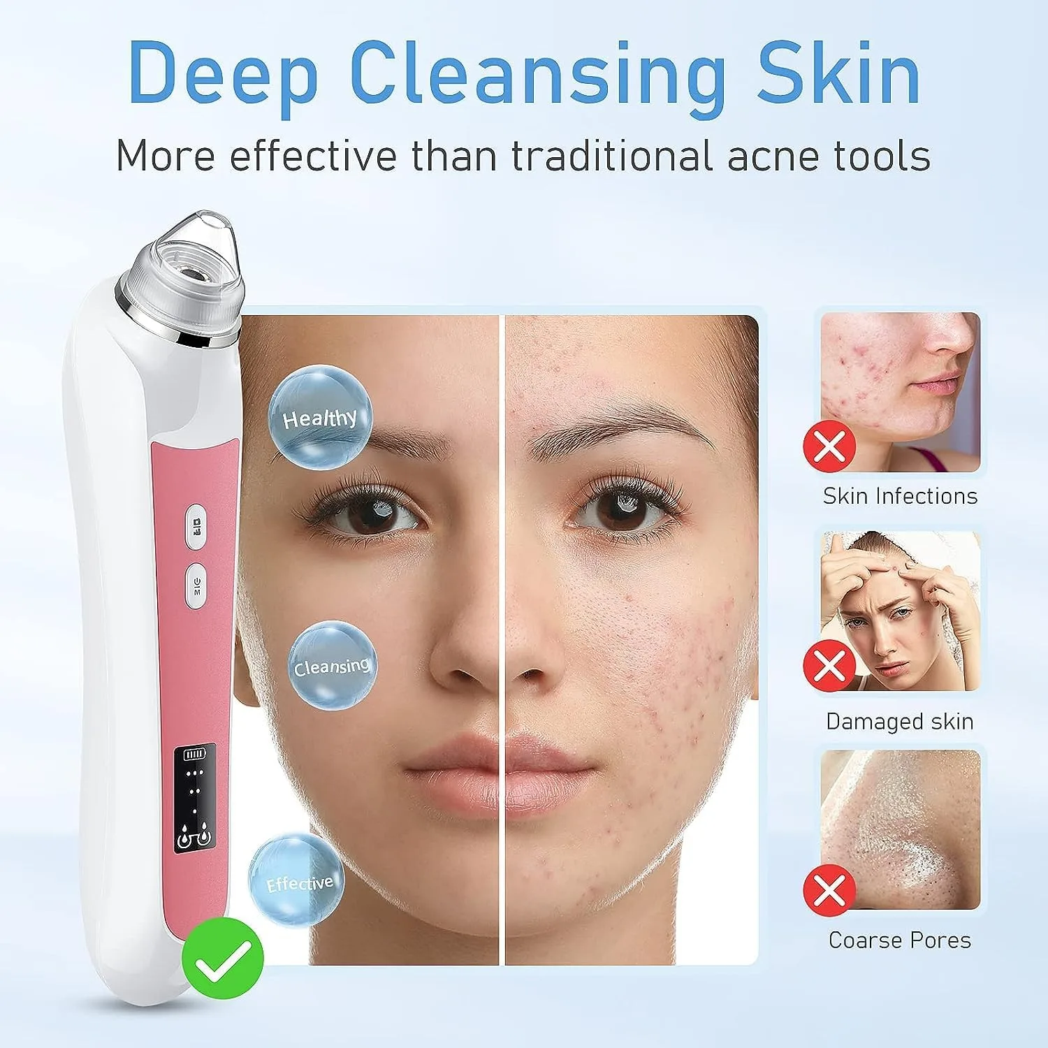 Blackhead Remover with Camera, 3 Levels, 6 Heads, USB Rechargeable