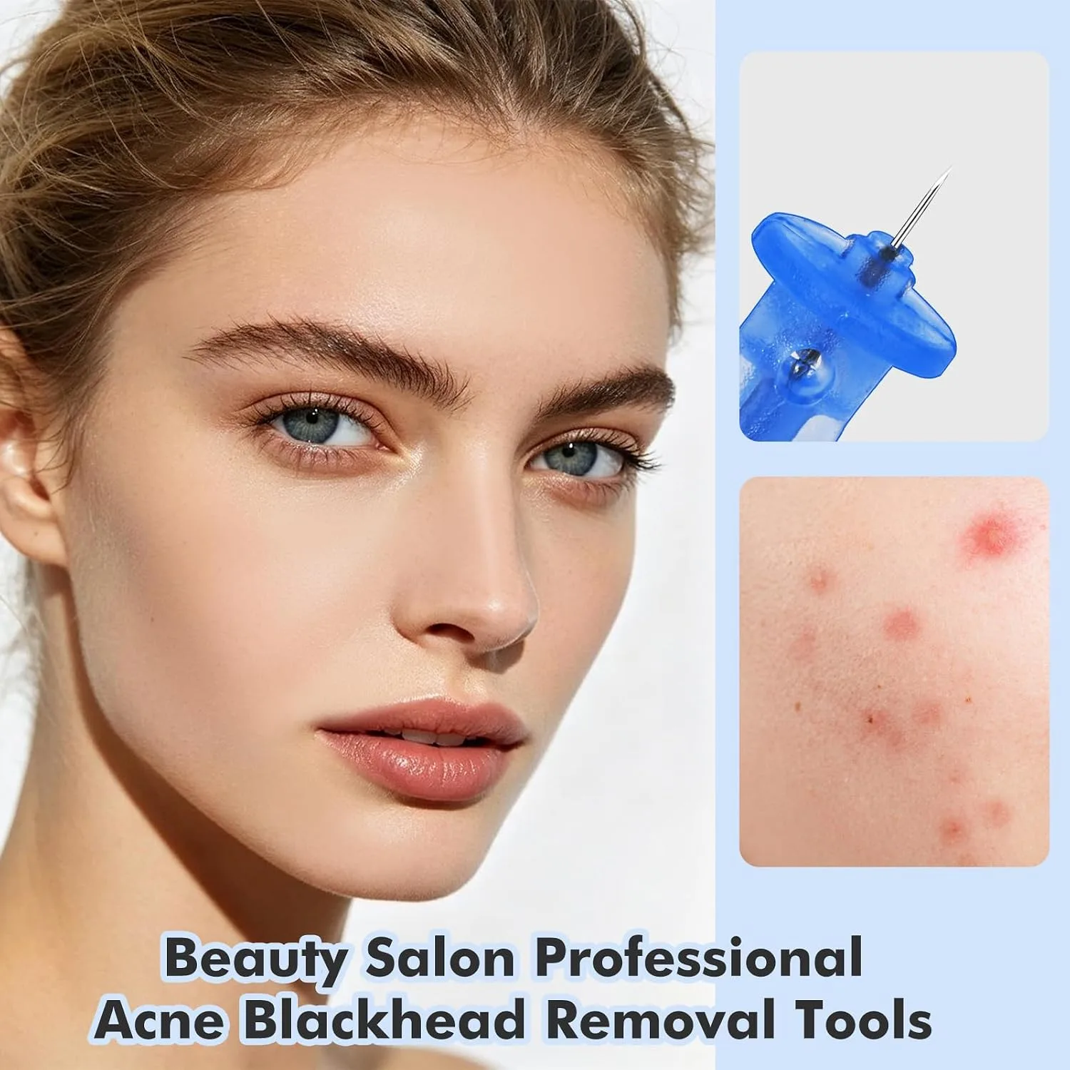 Professional 100 PCS Disposable Blackhead and Blemish Remover Tools
