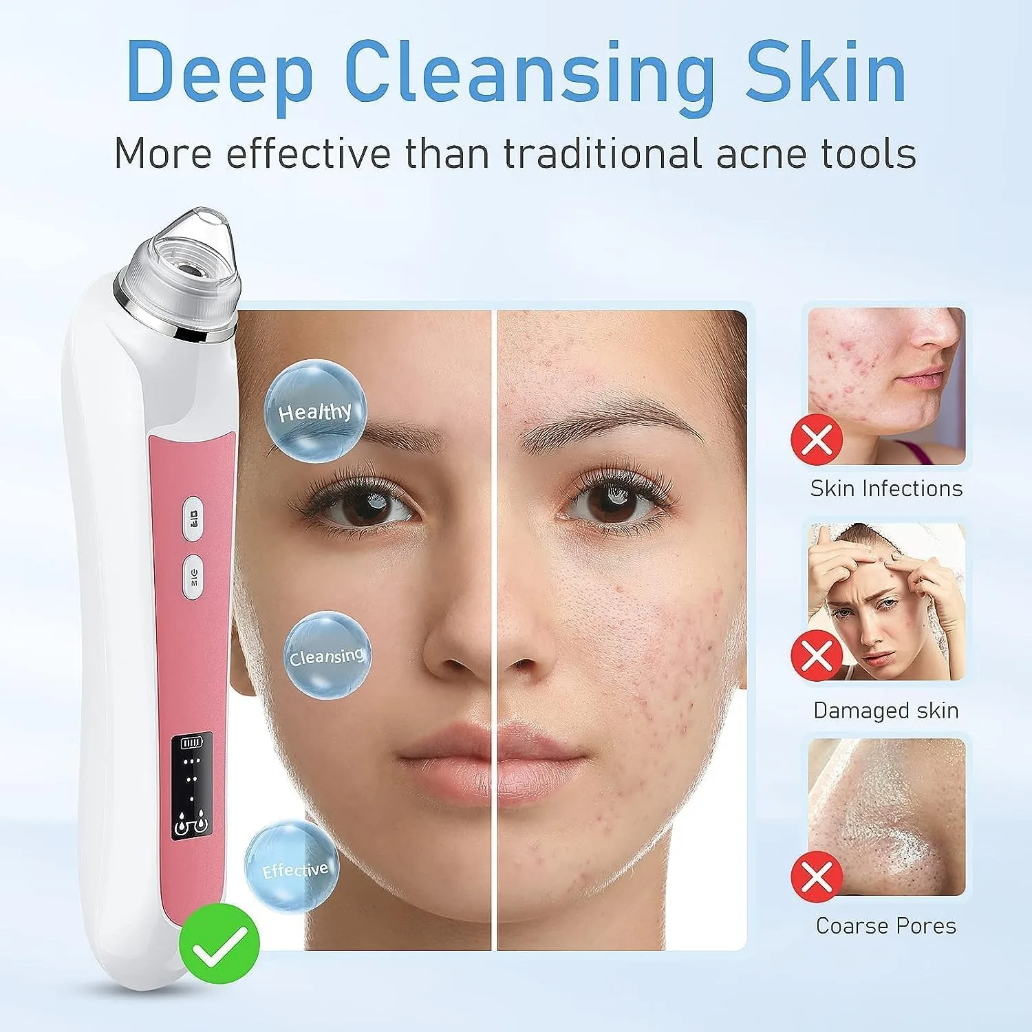 HD Camera USB Blackhead Remover Vacuum, 3 Modes(Sanguine Red)