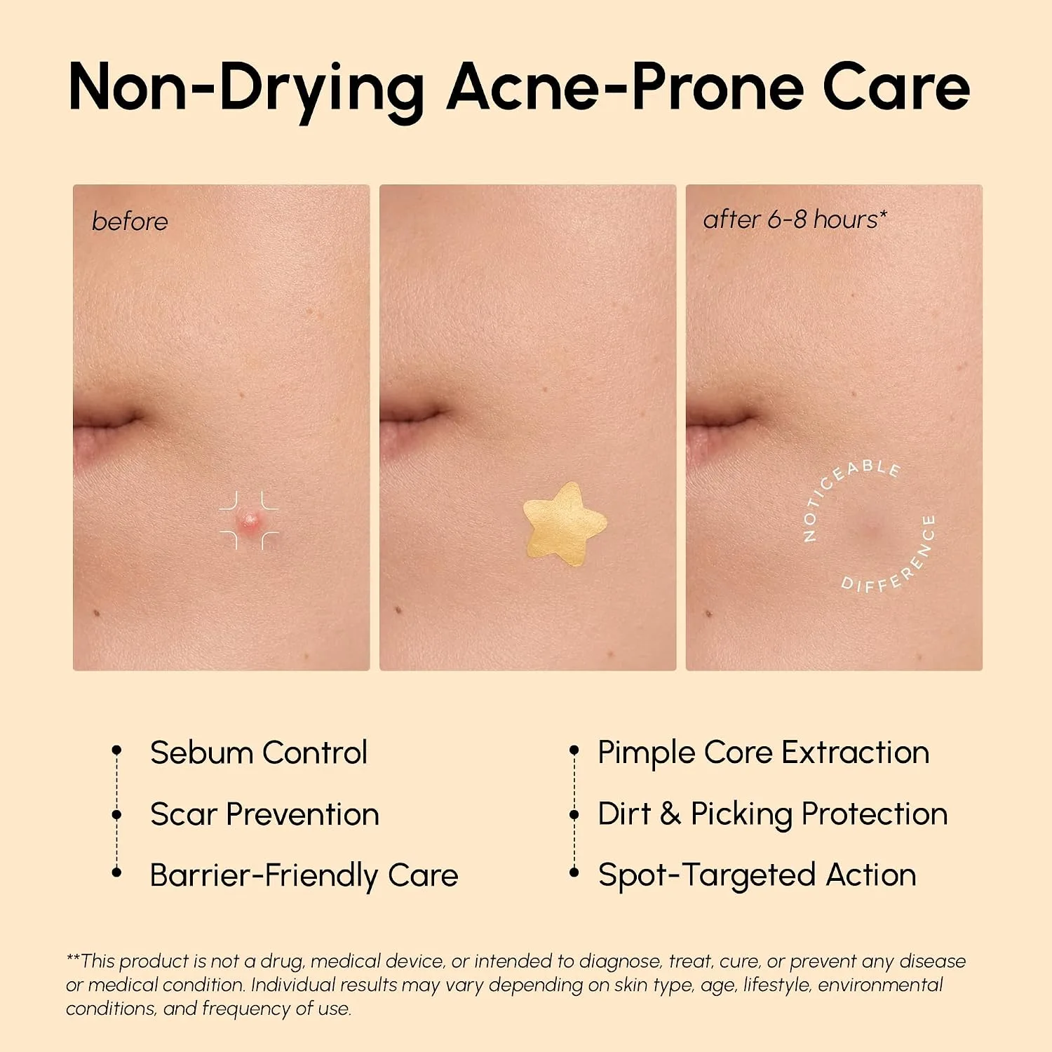 MAREE Gold Star Pimple Patches for Face - Star Acne Patches for Zits 72 Ct