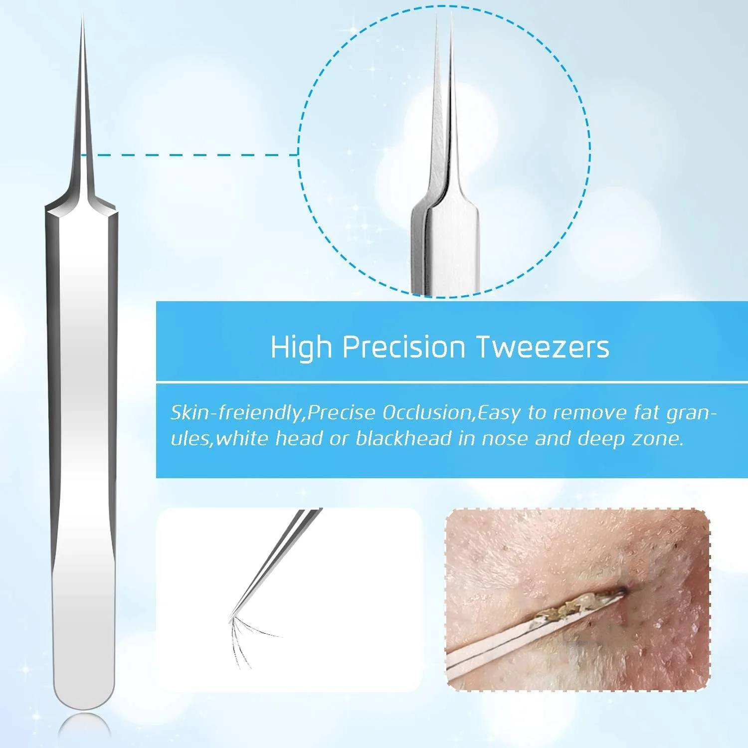 Best Blackhead Remover, Blackheads Blemish Removing, Acne Whitehead Removal Kit, Pimple Comedone Extractor Tool, Popper Pimples Treatment, with Tweezers, Risk Free for Face Forehead Nose