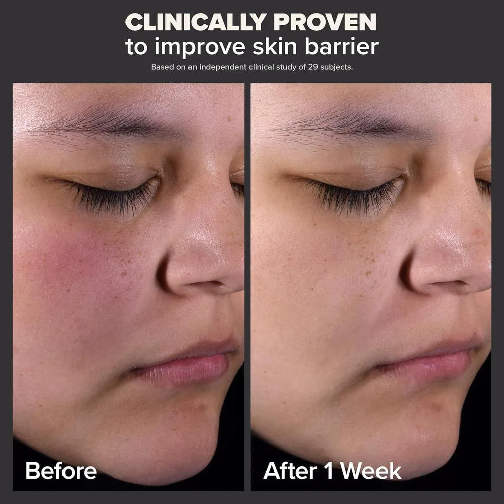 Perfeccionador De Piel Paula's Choice 2% BHA Ácido Salicílico, Exfoliante Líquido Para Puntos Negros Y Poros Abiertos, 118 Ml