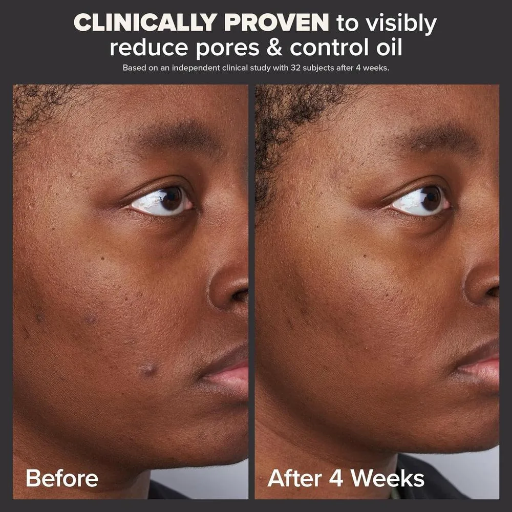 Perfeccionador De Piel Paula's Choice 2% BHA Ácido Salicílico, Exfoliante Líquido Para Puntos Negros Y Poros Abiertos, 118 Ml