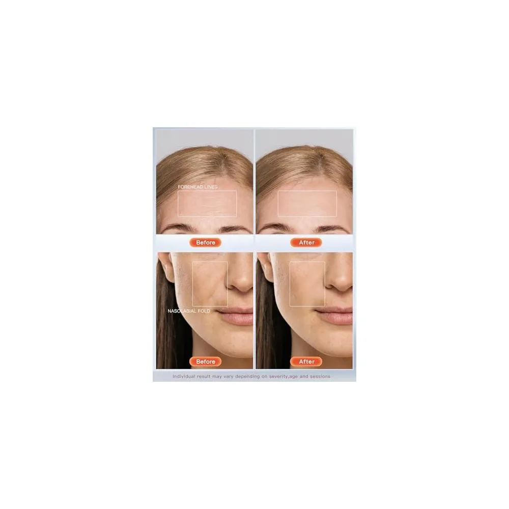 Sistema de terapia de fotones Newkey de luz LED de 7 colores para cuidado facial y máscara de belleza, trata arrugas y acné
