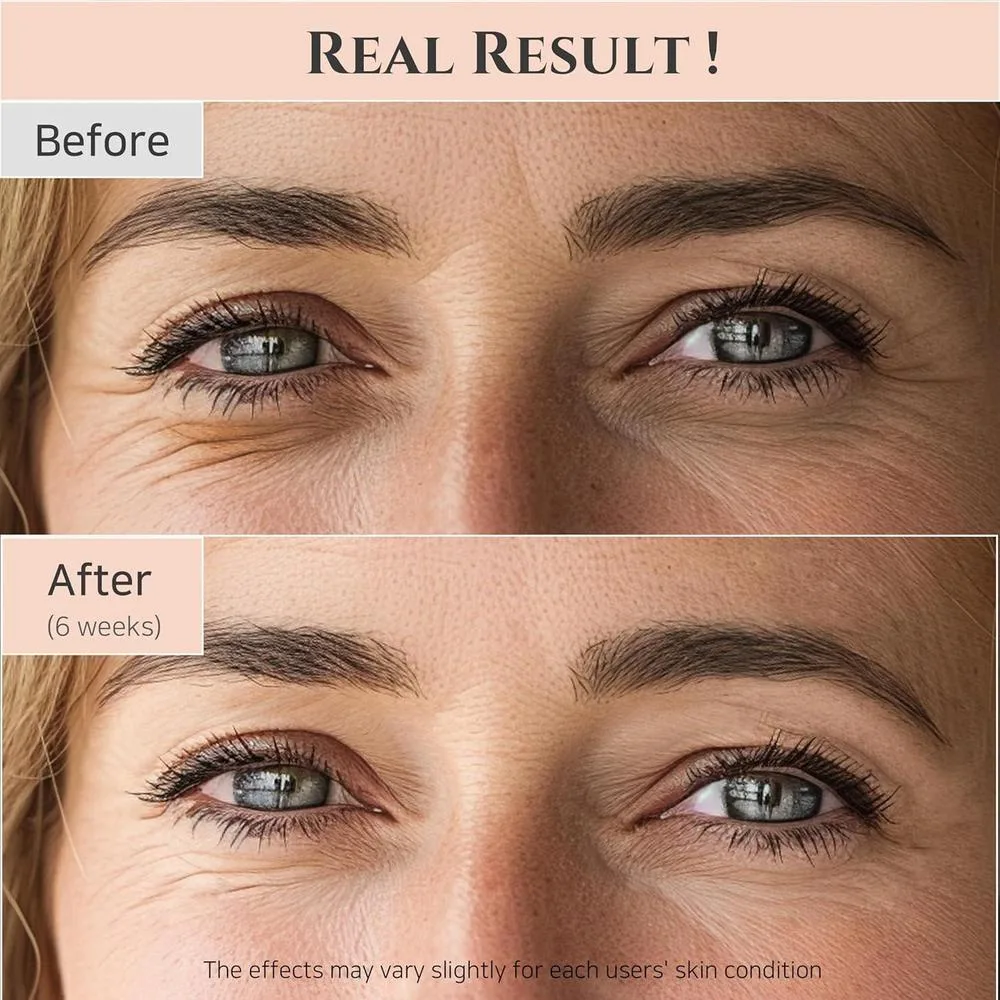 Beauty Of Joseon Retinol Niacinamide Eye Serum 30ml