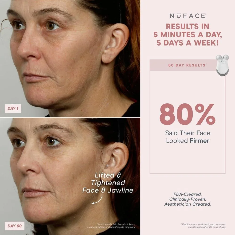 NuFACE MINI Classic Microcurrent, dispositivo facial para contornear, levantar, suavizar y tonificar con gel activador