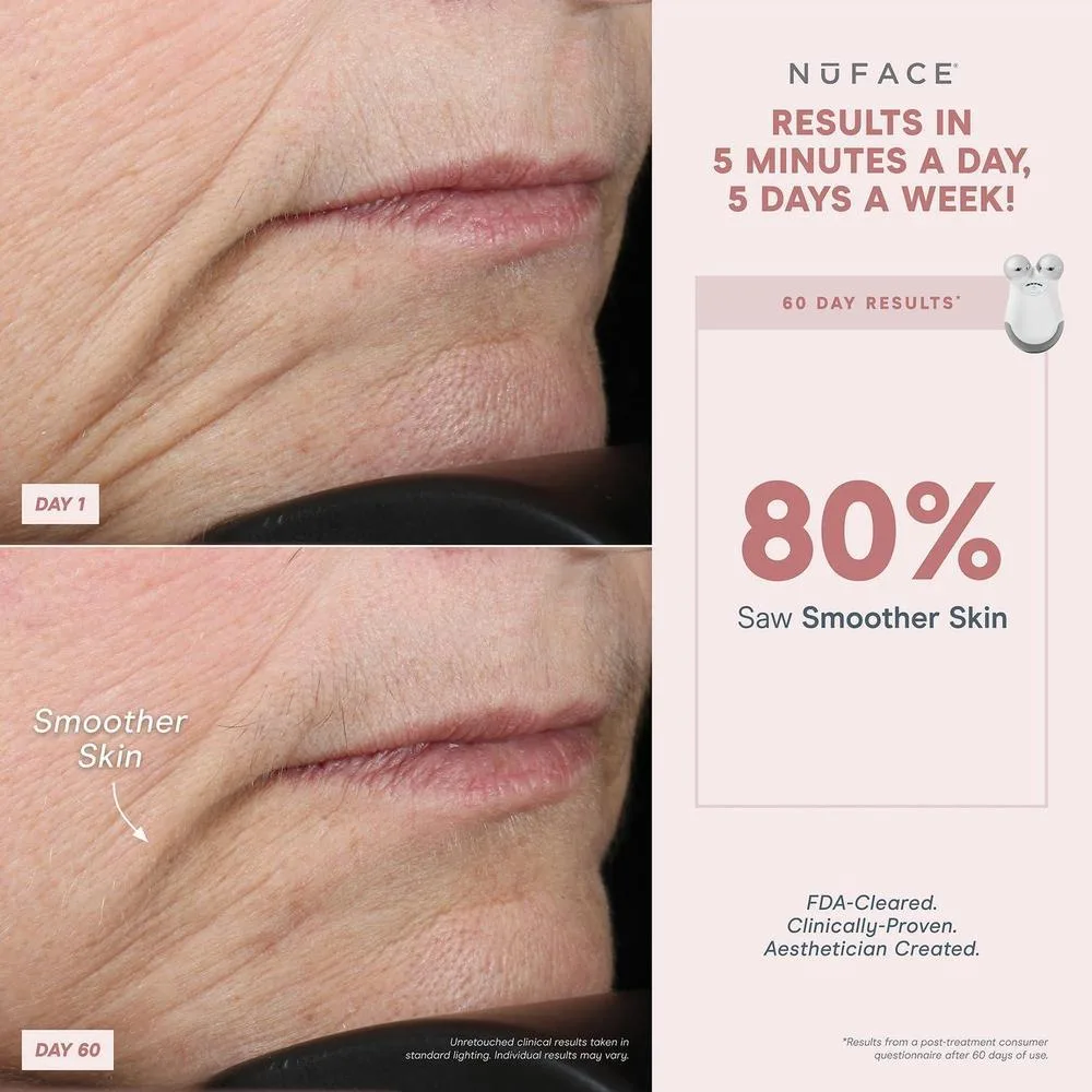 NuFACE MINI Classic Microcurrent, dispositivo facial para contornear, levantar, suavizar y tonificar con gel activador