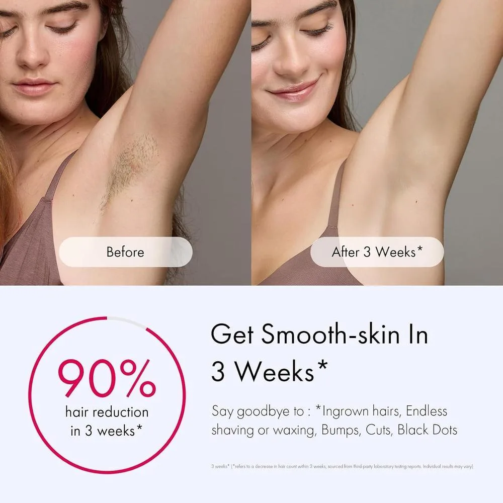 Ulike Depiladora IPL con Enfriamiento de Hielo y 3 Modos, para Resultados Indoloros y Duraderos, Rápida para Todo el Cuerpo