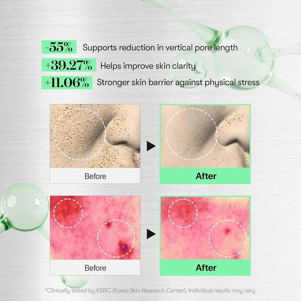 Vt Cosmetics Suero Microneedling Cica Reedle Shot 100 Exfoliación Poros 50ml