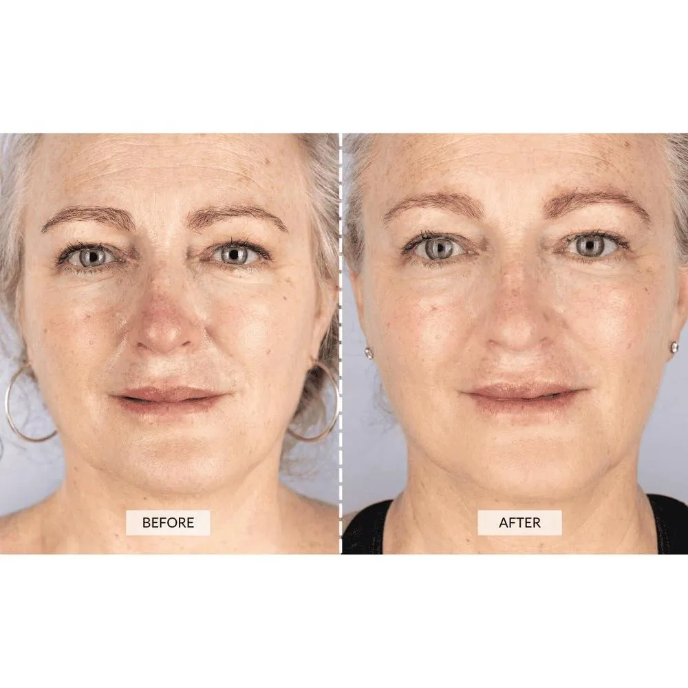 Máscara Facial LED de Terapia de Luz CurrentBody para Rejuvenecimiento y Reducción de Arrugas