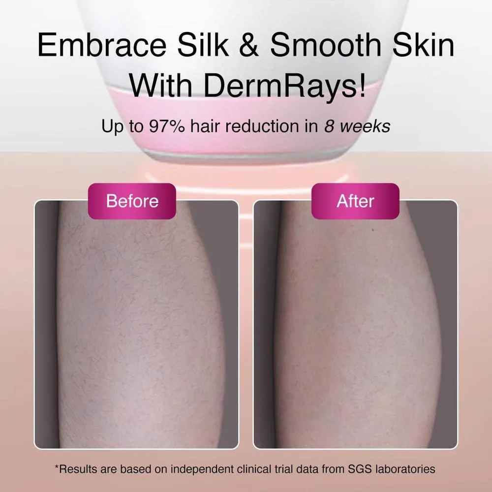 Depiladora láser de diodo DermRays para pieles oscuras con tecnología 1064nm, reducción de cabello permanente. Ideal para hombre y mujer