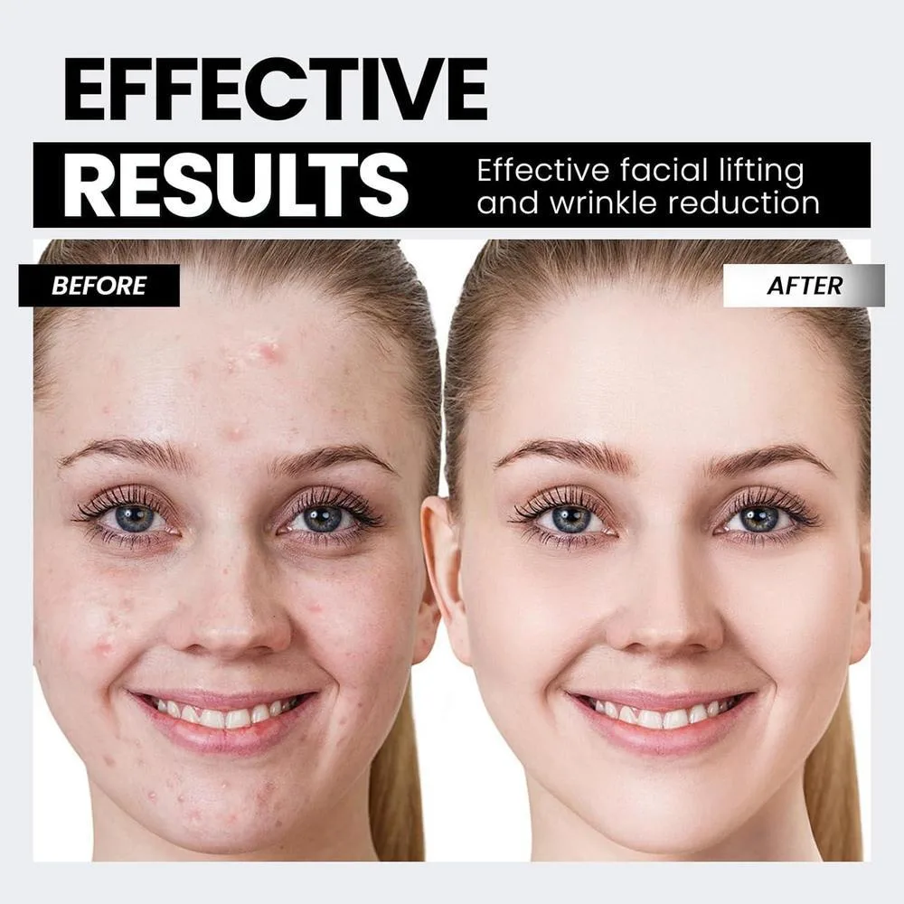 Dispositivo Facial con Tecnología de Microcorriente y Luz Roja para Levantar el Rostro y Tensar la Piel, Antiarrugas Inteligente