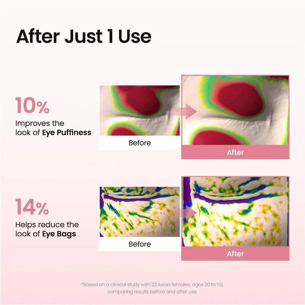 Parches De Péptido De Colágeno Biodance Para Reducir Arrugas Y Líneas Finas En Ojos