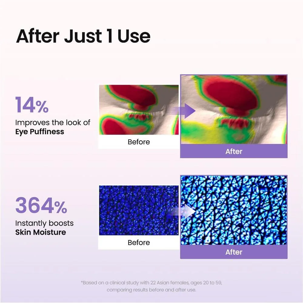 BIODANCE Parches oculares Caviar PDRN para círculos oscuros, ojos hinchados, nutrición profunda, regalo ideal