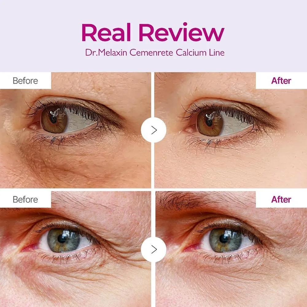 Dr.Melaxin Parche Ocular Calcio Y Colágeno Para Hidratación Y Firmeza