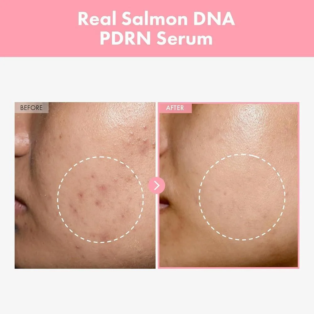 TOSOWOONG Suero Pink Peptide 12 PDRN Con ADN De Salmón 33ml