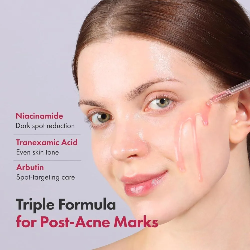TOSOWOONG Serum Niacinamide 10% + Tranexamic Acid 4% + Arbutin 2% + Hyaluronic Acid 33ml