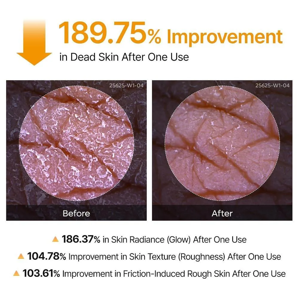 Dr.Melaxin Cuidado de Queratina Corporal Ácido Kójico Cúrcuma Spray Exfoliante Solución Peeling Cuidado Coreano