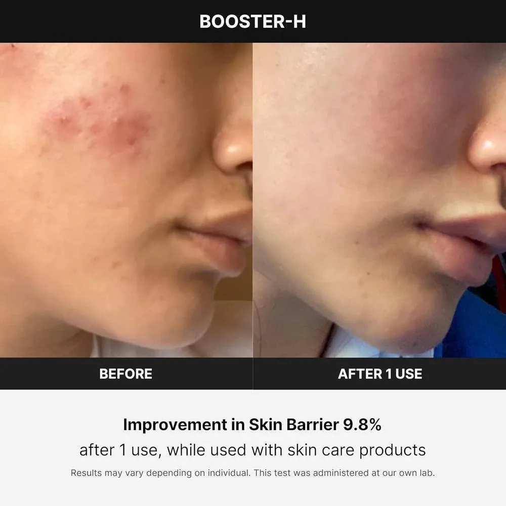medicube Booster H - Potenciador coreano de brillo facial para maximizar y potenciar la absorción del cuidado de la piel