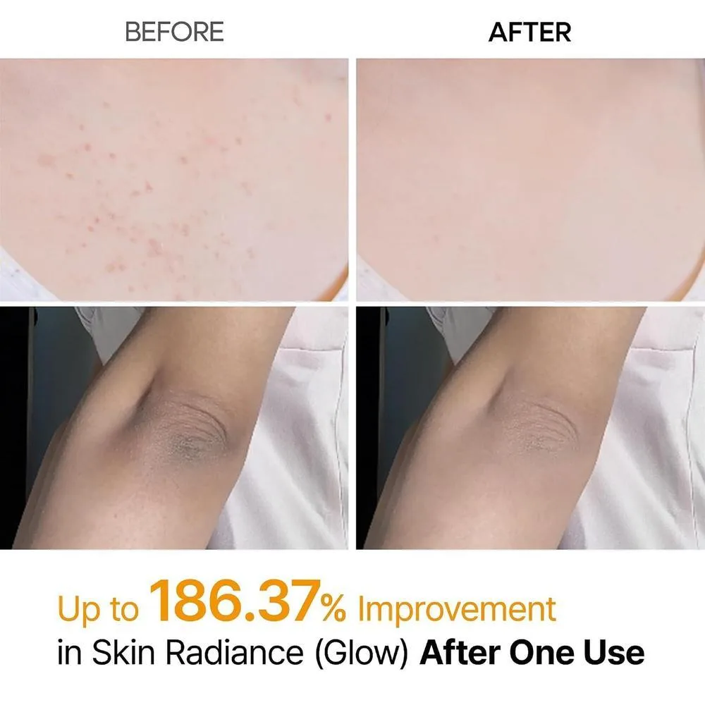 Dr.Melaxin Cuidado de Queratina Corporal Ácido Kójico Cúrcuma Spray Exfoliante Solución Peeling Cuidado Coreano