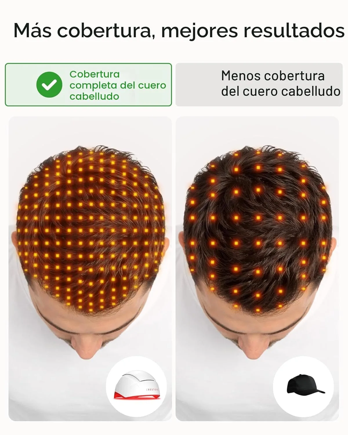 iRestore Professional - Sistema Láser de Crecimiento Capilar con 282 LEDs