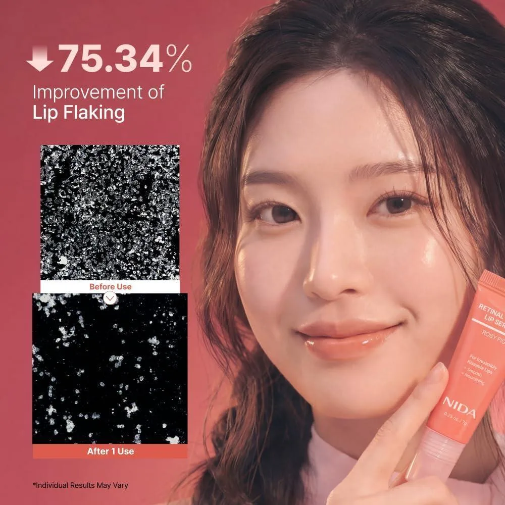 NIDA Retinal Glowy Lip Serum, suero labial hidratante que nutre, da brillo y volumen, ideal para labios suaves y jóvenes