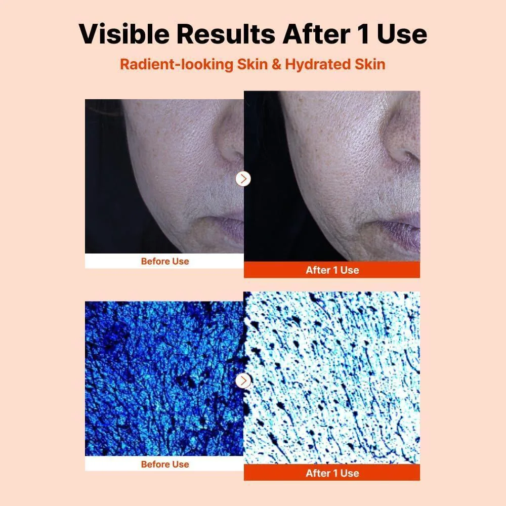 Nida Serum Facial Con Pdrn, Péptidos, Adenosina, Cafeína Para Hidratación Intensa 50ml