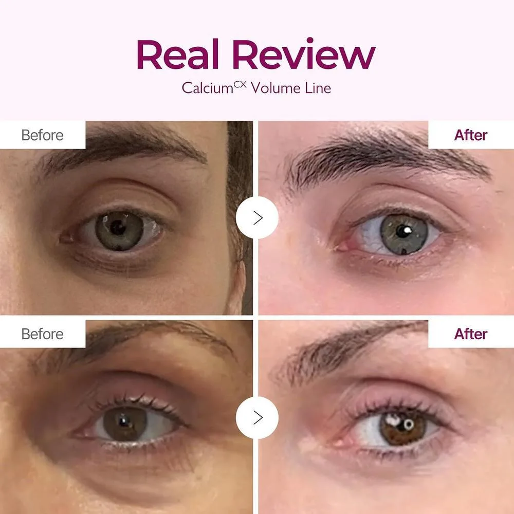 Dr.Melaxin Crema Reafirmante con Calcio, Colágeno y Elastina para Piel Flácida, con Niacinamida Hidratante