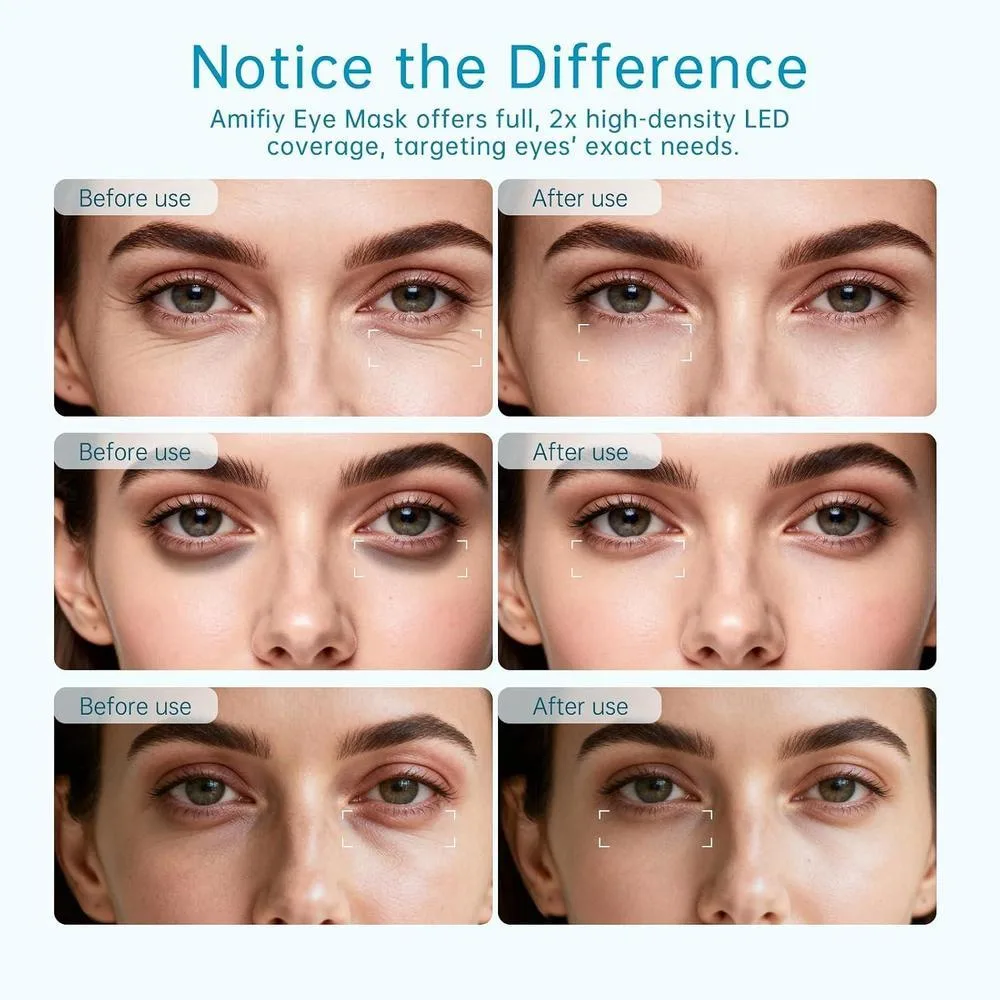 Máscara de ojos de luz roja infrarroja para ojeras, arrugas y bolsas. Dispositivo antienvejecimiento con 3 minutos por sesión
